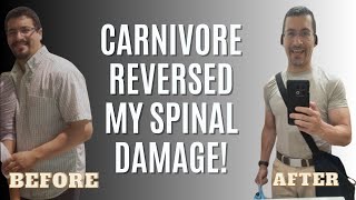 How the Carnivore Diet Transformed My Health and Fitness [upl. by Akinej]