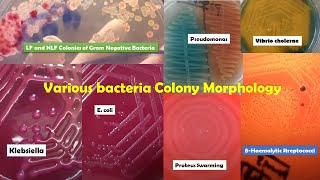 Various Bacteria Colonies Morphology Demo ProteusPseudomonasKlebsiellaPseudomonasStreptococcus [upl. by Estell]