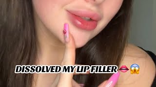 I DISSOLVED MY BOTCHED LIP FILLER [upl. by Nuncia]