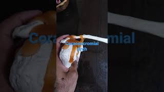 Coracoacromial Arch of the shoulder joint draqilshah anatomy viralvideos viral grossanatomy dr [upl. by Suriaj150]