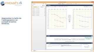 Les fonctionnalités du Module audiogramme [upl. by Harikahs]