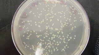 CFU Colony Forming Unit amp cfuml calculation [upl. by Locke501]