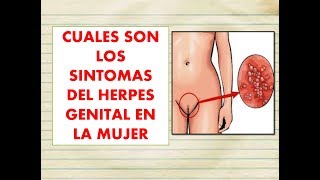 cuales son los SINTOMAS del HERPES GENITAL en la MUJER 🚨 como se CONTAGIA EL HERPES GENITAL MUJER [upl. by Ylatfen995]