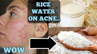 I Tested Rice Water for 1 Week Straight  SHOCKED BY THE RESULTS THIS IS HOW MY SKIN LOOKS NOW [upl. by Dedric]