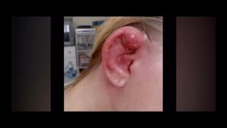 Infected Industrial Piercing 2008 [upl. by Atikan]