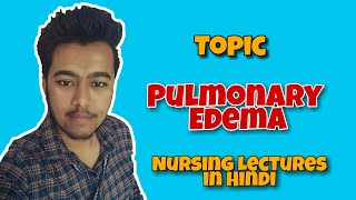 Pulmonary Edema  Nursing lecture in Hindi MSN 1 [upl. by Hallett464]