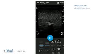 Philips Lumify Ultrasound Guided Injections Video Training Demonstration [upl. by Namharludba]