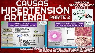 SINTOMAS DE HIPERTENSIÓN ARTERIAL FISIOPATOLOGÍA PARTE 2  GuiaMed [upl. by Maggs]