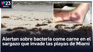 Alertan sobre bacteria come carne en el sargazo que invade las playas de Miami [upl. by Adneram]