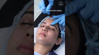 Watch the process of acne treatment at Skin Square [upl. by Yatzeck]