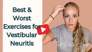 Best and Worst Vertigo Exercises for Vestibular Neuritis [upl. by Ayokahs31]