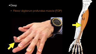 Forearm flexor muscles [upl. by Butta458]