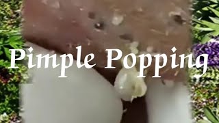 Pimple amp Blackheads Popping  24 [upl. by Morris396]