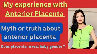 My experience with Anterior placentaAnterior Placenta complications and baby gender [upl. by Sclater]