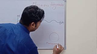 Mycosis Fungoides and Sezary Syndrome [upl. by Tabor532]