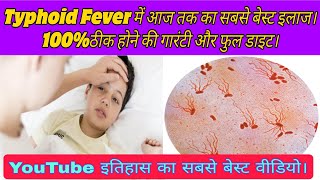 Typhoid fever causessymptomstestdiet and full treatment मोतीझरा का इलाजलक्षण कारणजांचे परहेज। [upl. by Garek121]