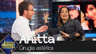 Anitta explica su afición a la cirugía estética quotYo misma diseñé mi caraquot  El Hormiguero 30 [upl. by Esilehc910]