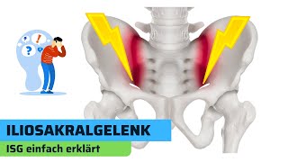 Iliosakralgelenk ISG Grundlagen bei Rückenschmerzen [upl. by Akemat144]