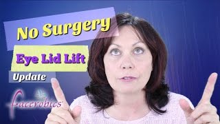 How to Get Rid of Droopy Eye Lids No Surgery Eye Lid Lift Hooded Eye Lid Lift  FACEROBICS® [upl. by Scheck]