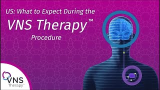 US What to Expect During the VNS Therapy™ Procedure [upl. by Aiekat]