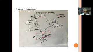 Clinical approach to diplopia [upl. by Gnilyam]