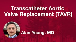 Transcatheter Aortic Valve Replacement TAVR [upl. by Tera]