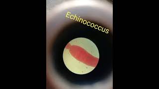 Echinococcus shorts shortsvideo youtubeshorts [upl. by Jet]