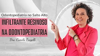 Infiltrante Resinoso na Odontopediatria [upl. by Sedicla]