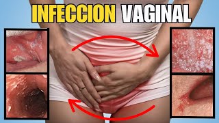 Infecciones Vaginales  Síntomas y Soluciones [upl. by Cayser]