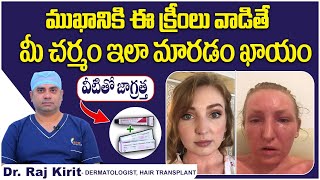 ఆ క్రీంలు వాడడం వల్ల  Skin Lite Cream Side Effects On Face  Steroid Cream  Celestee Clinic [upl. by Nehgaem771]