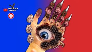 Asmr Infected Hand Treatment Maggots amp Trypophobia  2D Animation Cleaning ASMRStudioByRahul [upl. by Anrat]