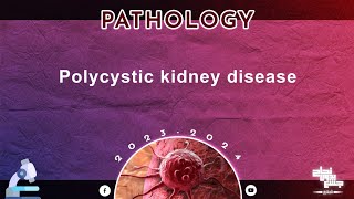 L  Polycystic kidney disease BNU Pathology [upl. by Beghtol]