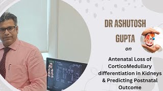 Antenatal Loss of CorticoMedullary differentiation in Kidneys amp Predicting Postnatal Outcome [upl. by Lomasi665]