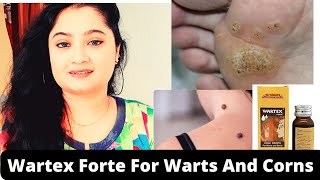 Wartex Forte Drops For Warts And Corns In Hindi Anusuya Chakrabarti Wartex Forte Drops Review [upl. by Jo-Anne]