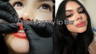 Getting my lip filler dissolved  raw footage [upl. by Leonid]