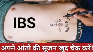 अपना IBS खुद चेक करें  रूपये बरबाद करने से बचें  Neurotherapy treatment for IBS  neurotherapy [upl. by Hemingway224]