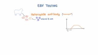 Epstein Barr Virus EBV Diagnosis and Testing [upl. by Lauree254]