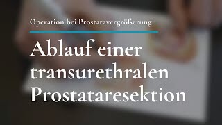 Prostatavergrößerung Ablauf einer transurethralen Prostataresektion TURP [upl. by Amena423]