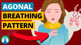 Agonal Breathing Medical Definition  Quick Explainer Video [upl. by Ase289]