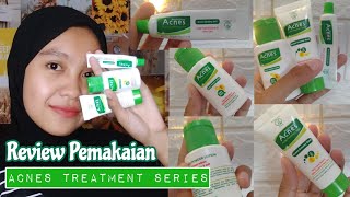 Review Acnes Treatment Series  Skincare kulit berminyak amp berjerawat [upl. by Nnoryt]