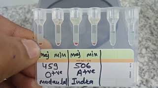 medicallabtechnologist6489 Blood Crossmatch Gel card method AgAbReaction MLT lab Blood [upl. by Ceporah]