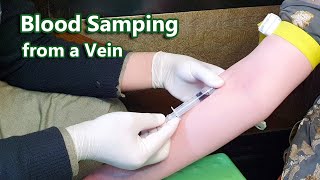 How to Take Venous Blood Sample  Venipuncture  Phlebotomy  Vein [upl. by Amairam]