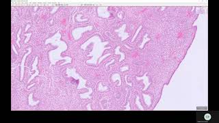 Introduction to Pathology Secretory endometrium 12 [upl. by Dressler]