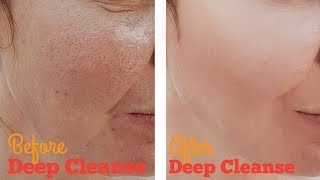 How to Deep Clean Facial Pores with Home Remedies [upl. by Nwavahs]