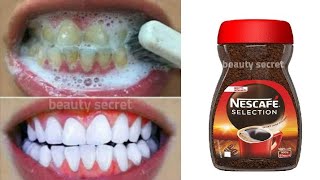 Teeth whitening in 1 minute removing the yellowness and tartar accumulated in the teeth💯 effective [upl. by Olson325]