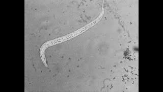 Nemátodo vs Trichoderma spp [upl. by Arrol]