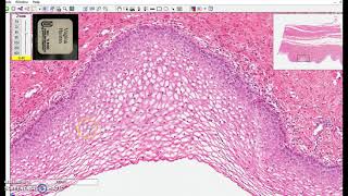 Diagnosing and Treating Pituitary Tumors  California Center for Pituitary Disorders at UCSF [upl. by Atikihs366]