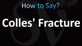 How to Pronounce Colles Fracture [upl. by Radcliffe]