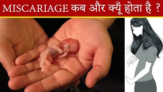 कैसे पता करे PERIODS हुआ या MISCARRIAGE   Miscarriage Blood Color amp Symptoms In Pregnancy  Mylo [upl. by Mcnamee468]