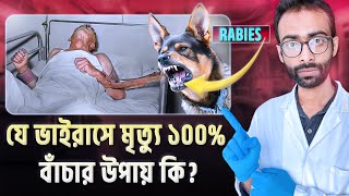 Rabies ভাইরাস শরীরে ঢুকলে কি ঘটে নিশ্চিত মৃত্যু থেকে বাঁচার উপায় কি Sabbir Ahmed [upl. by Latsirhc]